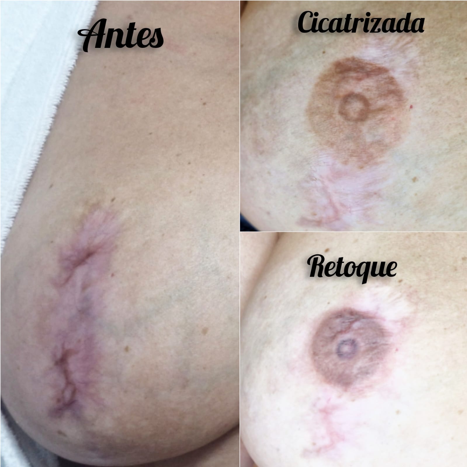 Micropigmentação de Aréola em Santo André | Sarita Messias