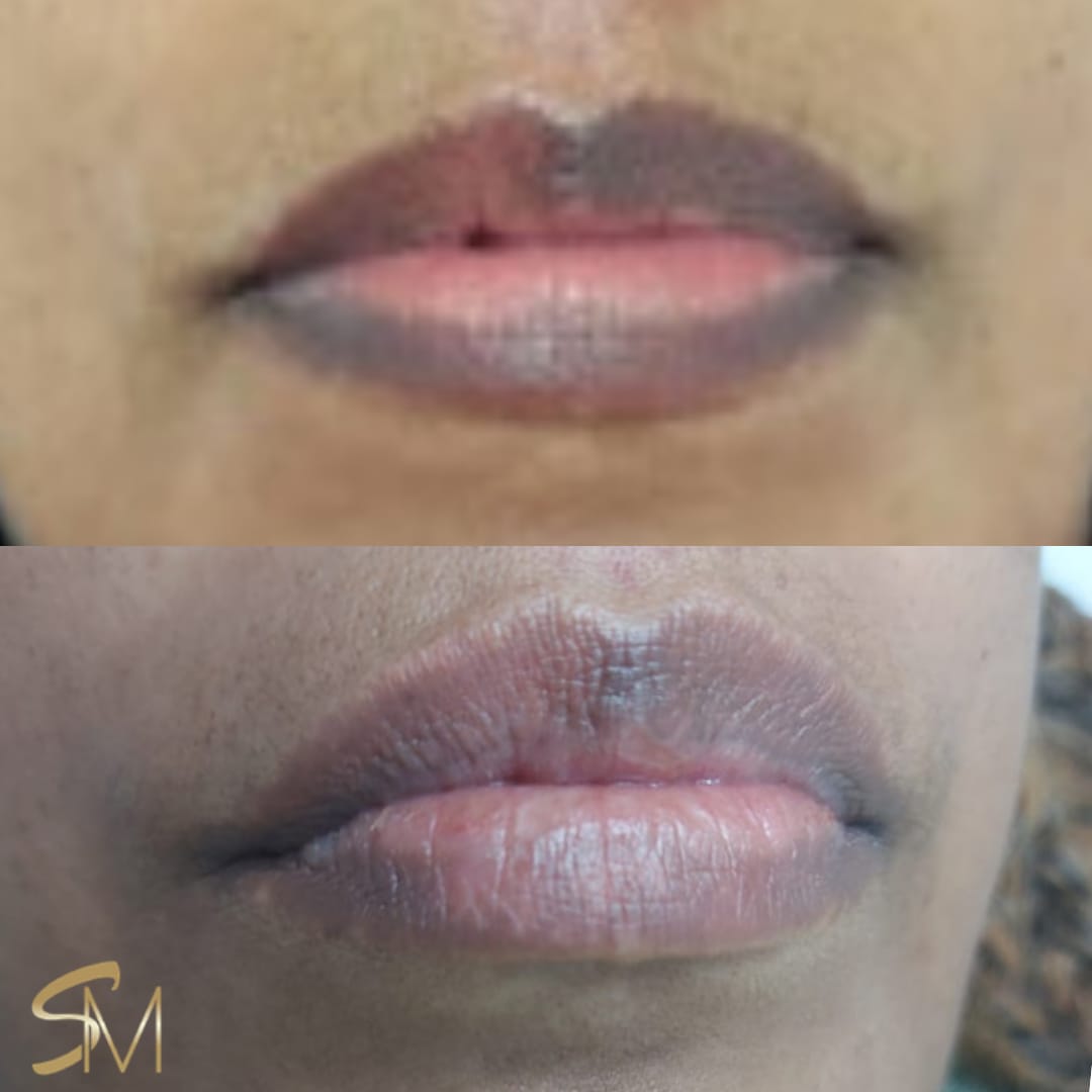 Micropigmentação Labial em Santo André | Sarita Messias