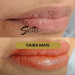 Artes e posts · Sarita Messias — clínica de estética em Jardim, Santo André - SP