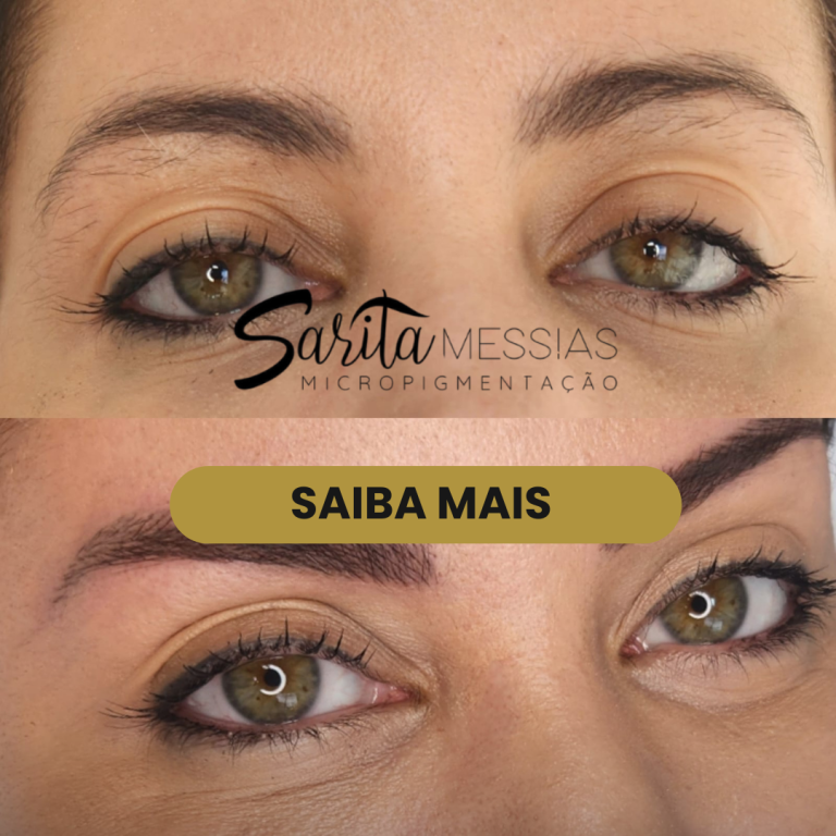Artes e posts · Sarita Messias — clínica de estética em Jardim, Santo André - SP