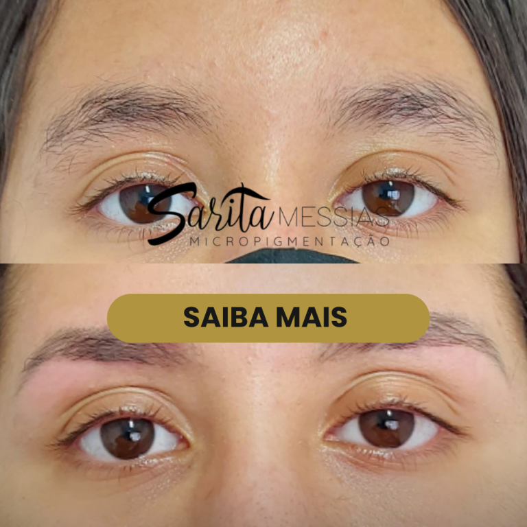 Artes e posts · Sarita Messias — clínica de estética em Jardim, Santo André - SP