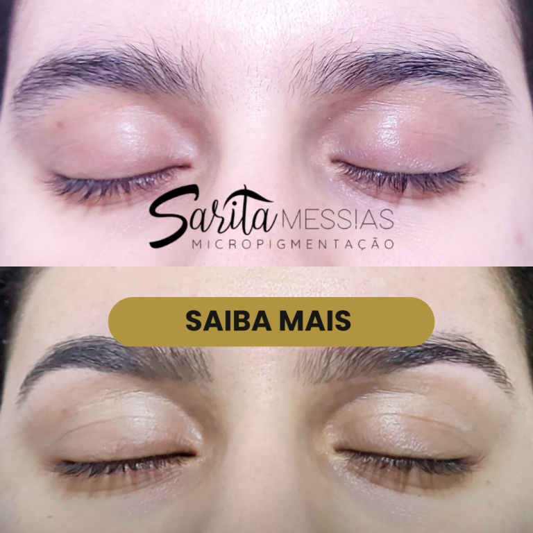 Artes e posts · Sarita Messias — clínica de estética em Jardim, Santo André - SP