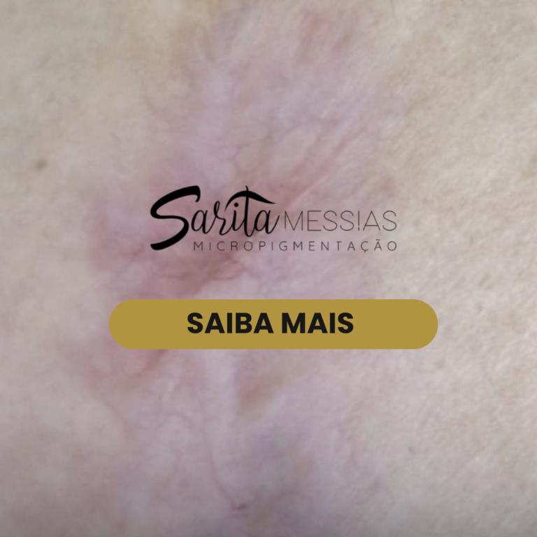 Artes e posts · Sarita Messias — clínica de estética em Jardim, Santo André - SP