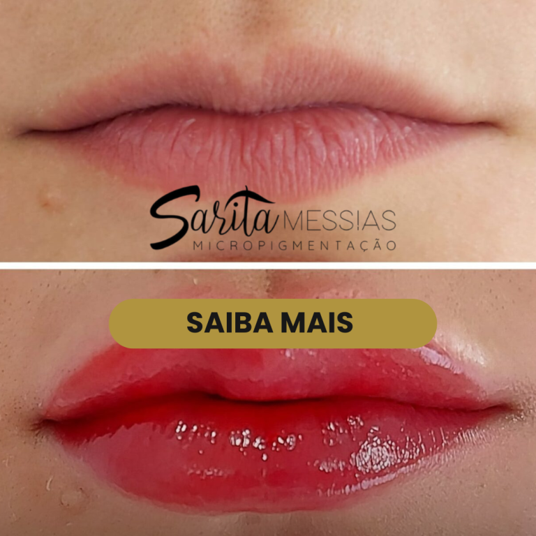Artes e posts · Sarita Messias — clínica de estética em Jardim, Santo André - SP