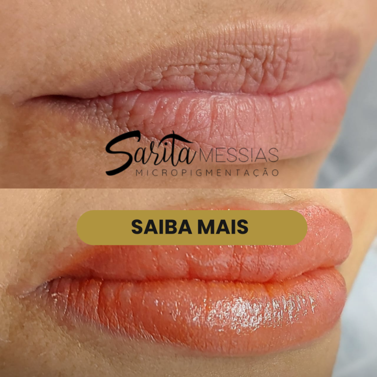 Artes e posts · Sarita Messias — clínica de estética em Jardim, Santo André - SP